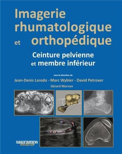 Imagerie rhumatologique et orthopédique. Ceinture pelvienne et membre inférieur