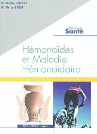 Hémorroïdes et maladie hémorroïdaire : savoir utile !