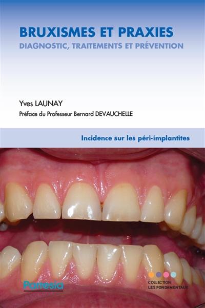 Bruxismes et praxies : diagnostic, traitements et prévention : incidence sur les péri-implanties