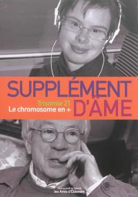 Supplément d'âme : trisomie 21, le chromosome en +