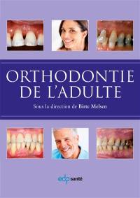 Orthodontie de l'adulte