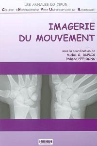 Imagerie du mouvement