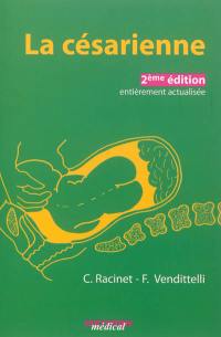 La césarienne : une approche fondée sur les faits