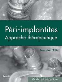 Péri-implantites : approche thérapeutique