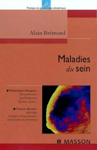 Maladies du sein