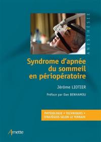 Syndrome d'apnée du sommeil en périopératoire : physiologie, techniques, stratégies selon le terrain