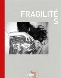 Fragilités