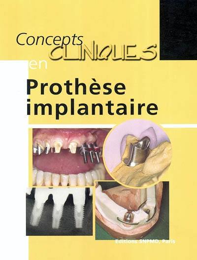 Concepts cliniques en prothèse implantaire