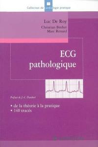 ECG pathologique : de la théorie à la pratique, 140 tracés