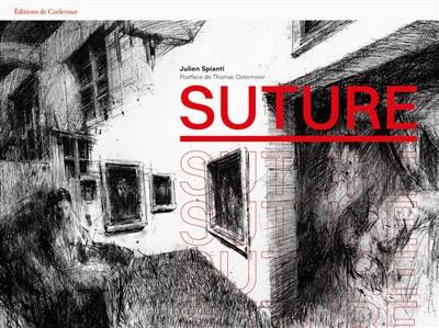 Suture