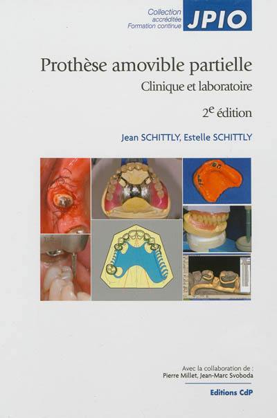 Prothèse amovible partielle : clinique et laboratoire