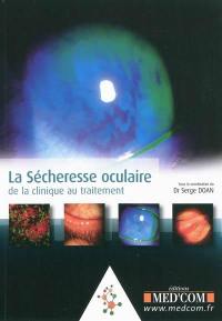 La sécheresse oculaire : de la clinique au traitement