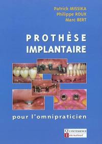 Prothèse implantaire : pour l'omnipraticien