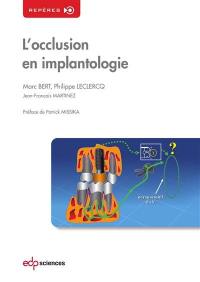 L'occlusion en implantologie