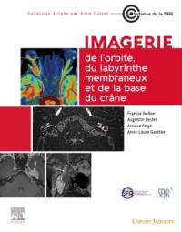 Imagerie de l'orbite, du labyrinthe membraneux et de la base du crâne