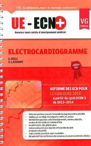 Electrocardiogramme