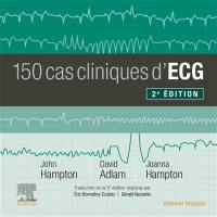 150 cas cliniques d'ECG