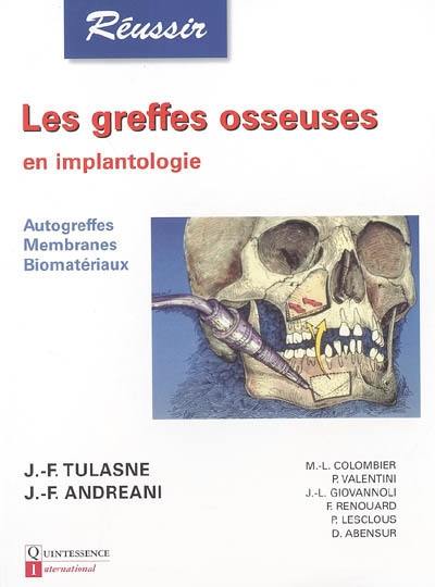 Les greffes osseuses en implantologie