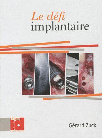 Le défi implantaire