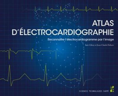 Atlas d'électrocardiographie : reconnaître l'électrocardiogramme par l'image