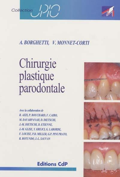 Chirurgie plastique parodontale