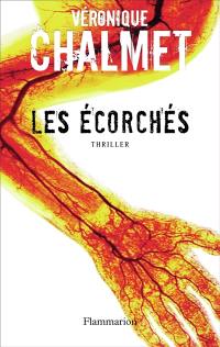 Les écorchés : thriller