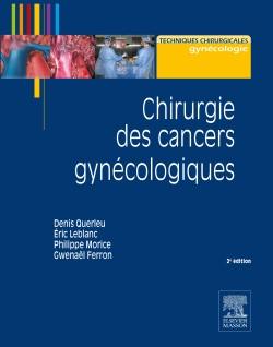 Chirurgie des cancers gynécologiques