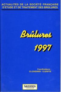 Brûlures 1997