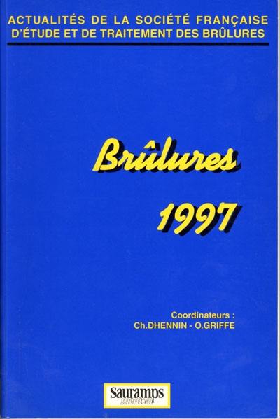 Brûlures 1997