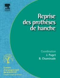 Reprise des prothèses de hanche