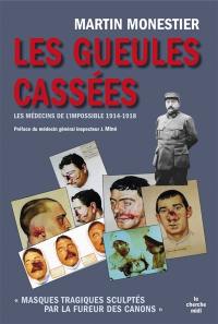 Les gueules cassées