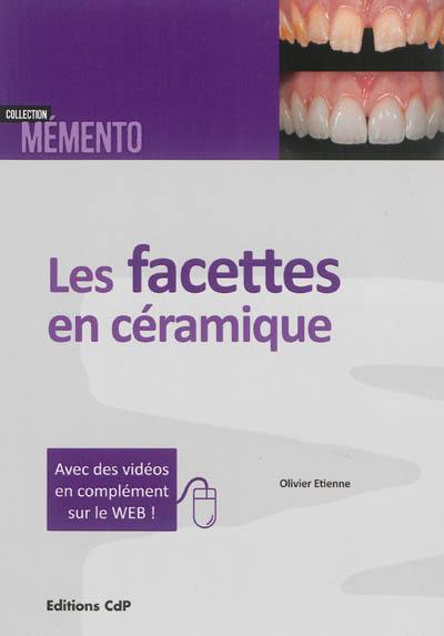 Facettes en céramique