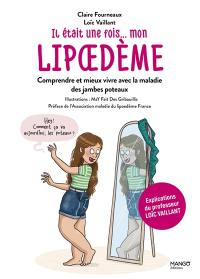 Il était une fois... mon lipoedème : comprendre et mieux vivre avec la maladie des jambes poteaux