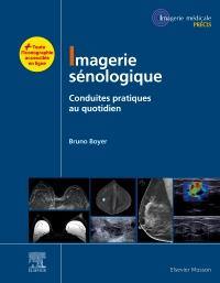 Imagerie sénologique : conduites pratiques au quotidien