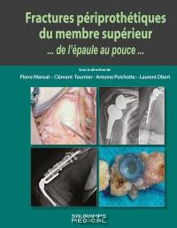 Fractures périprothétiques du membre supérieur : de l'épaule au pouce...