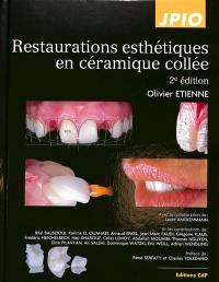 Restaurations esthétiques en céramique collée