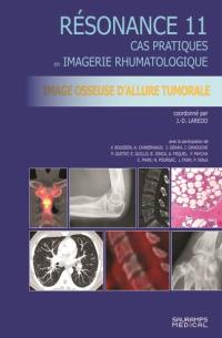 Résonance : cas pratiques en imagerie rhumatologique. Vol. 11. Image osseuse d'allure tumorale