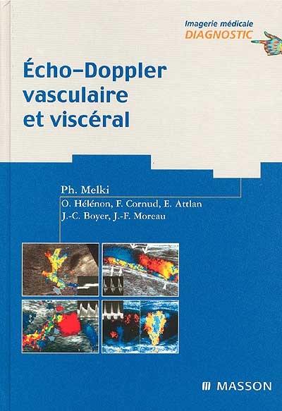 Echo-Doppler vasculaire et viscéral