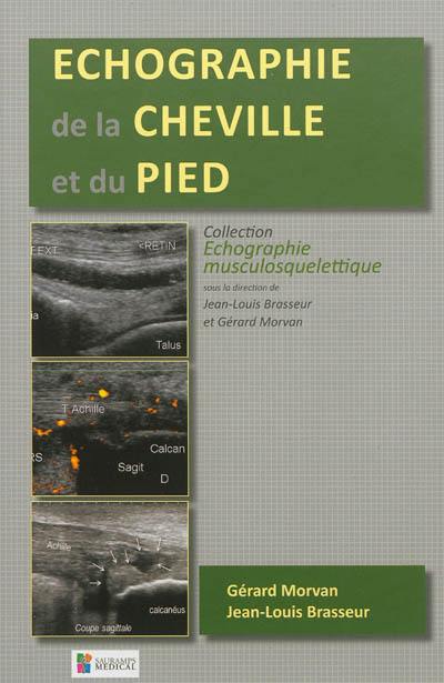 Echographie de la cheville et du pied