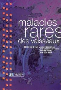 Maladies rares des vaisseaux