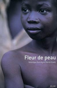 A fleur de peau