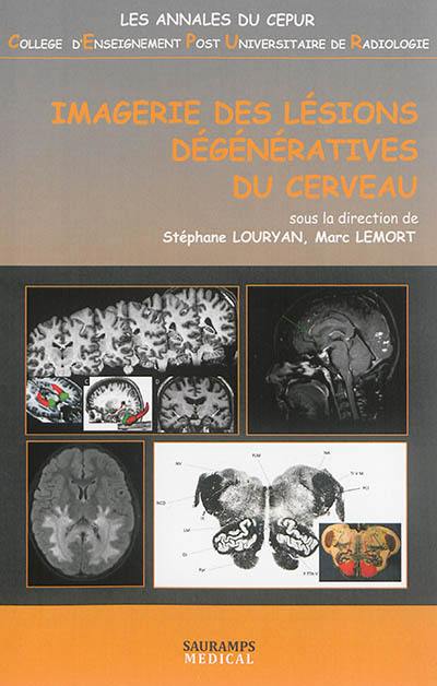 Imagerie des lésions dégénératives du cerveau Imagerie des lésions dégénératives du cerveau