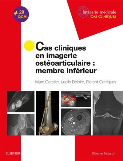 Cas cliniques en imagerie ostéoarticulaire : membre inférieur