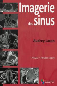 Imagerie des sinus