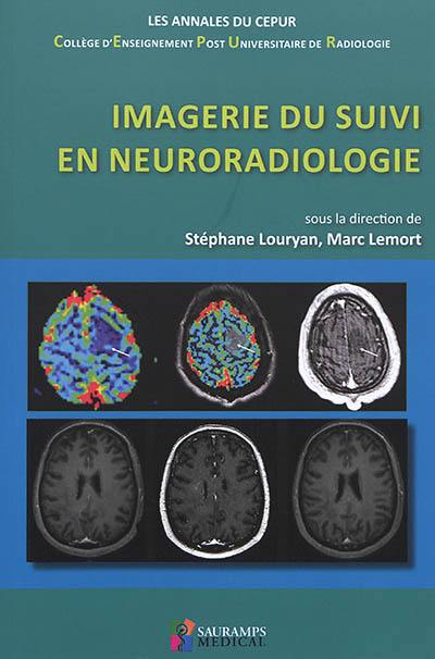 Imagerie du suivi en neuroradiologie Imagerie du suivi en neuroradiologie