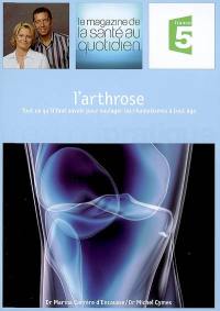 L'arthrose : tout ce qu'il faut savoir pour soulager les rhumatismes à tout âge