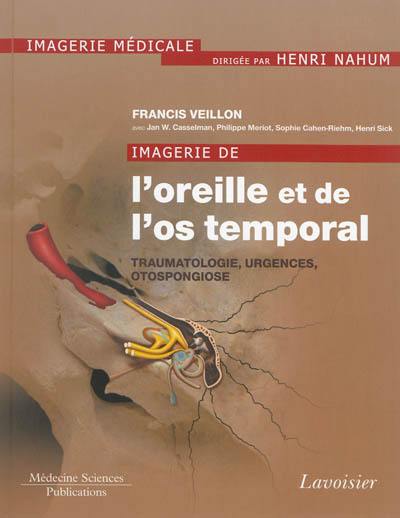 Imagerie de l'oreille et de l'os temporal. Vol. 3. Traumatologie, urgences, otospongiose