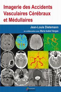 Imagerie des accidents vasculaires cérébraux et médullaires