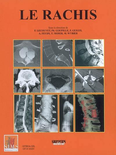 Le rachis : pathologie discale, rachis neuroradiologique, rachis dégénératif et sténose, rachis tumoral, rachis inflammatoire et infectieux, spondylolyse, scolioses : congrès thématique de juin, Opus XXXV