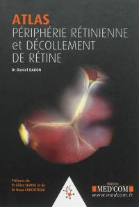 Périphérie rétinienne, décollements de rétine